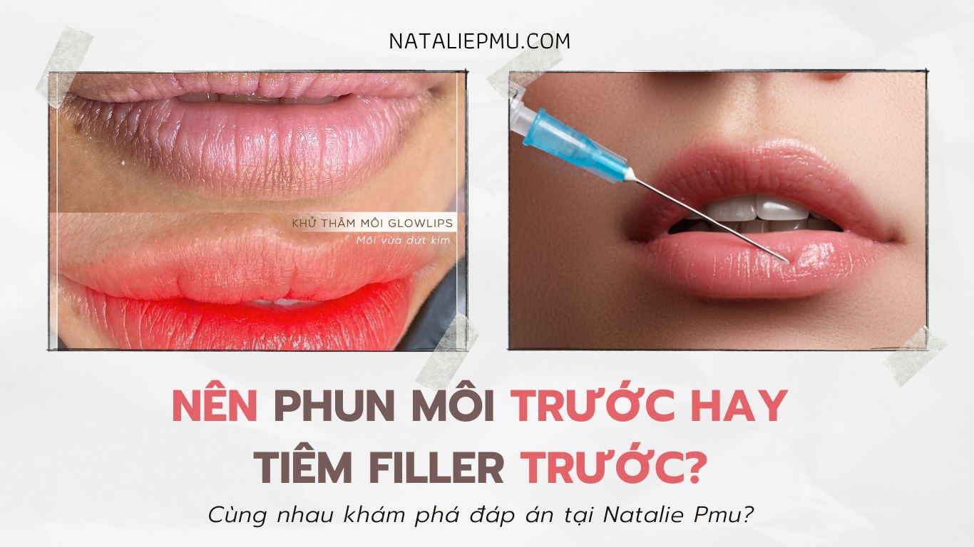 Giải đáp: Nên phun môi trước hay tiêm filler trước? Tại sao?